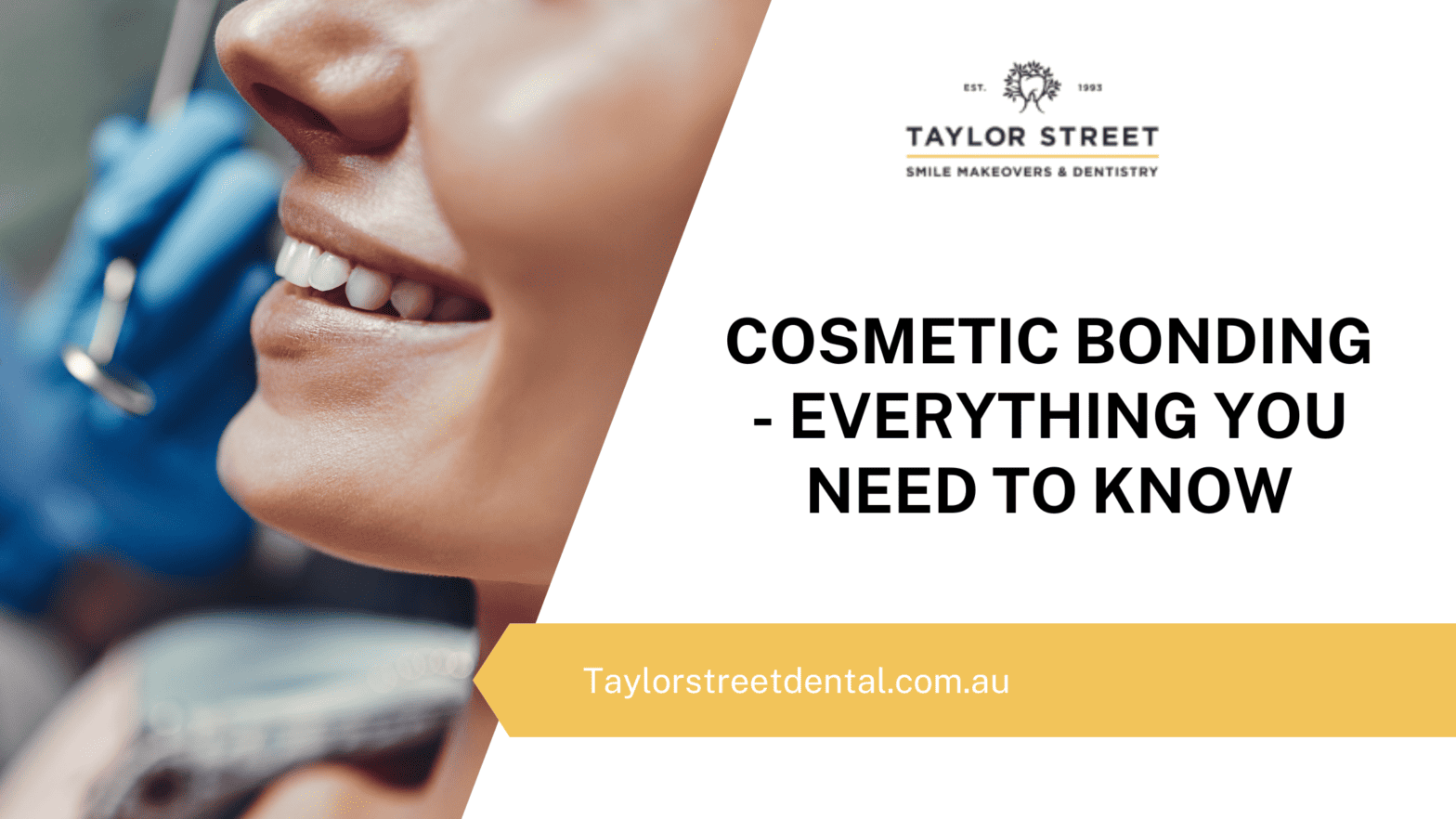Cosmetic bonding everything you need to know
